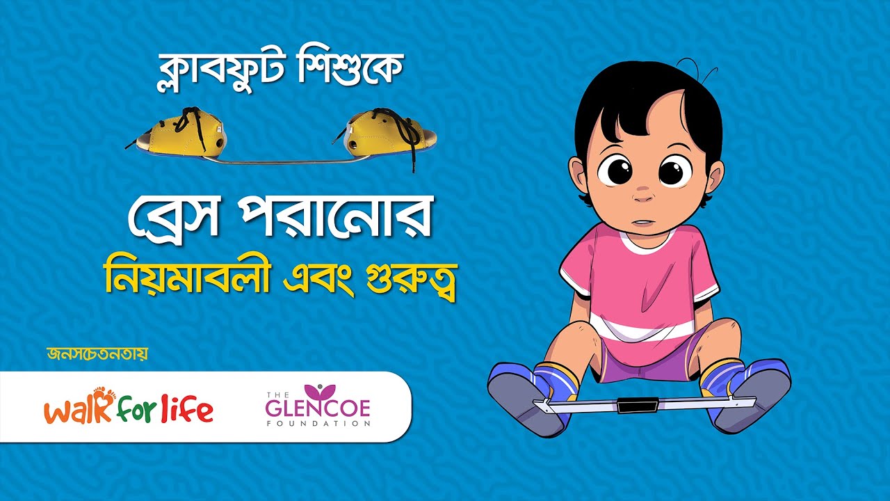 ক্লাবফুট শিশুকে ব্রেস পরানোর নিয়মাবলী এবং গুরুত্ব (প্রচারেঃ ওয়াক ফর লাইফ)
