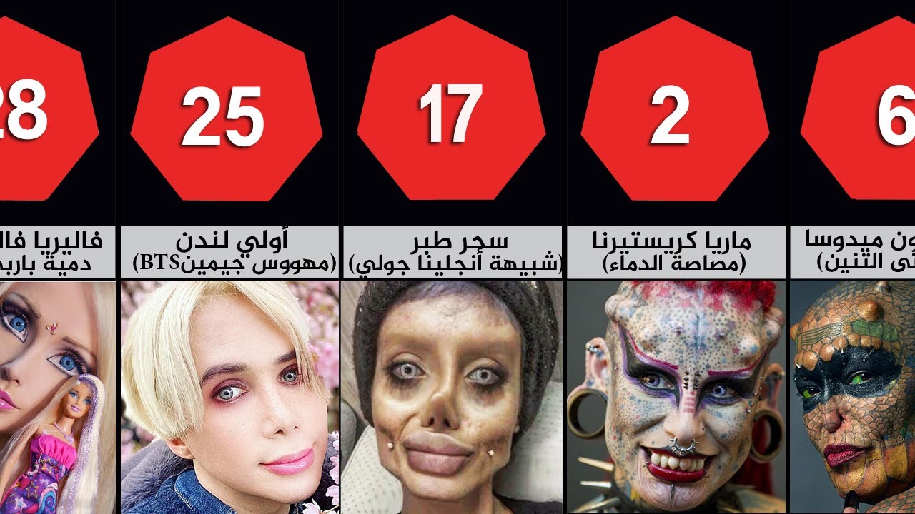 أغرب عمليات التجميل وأكثرها جنونا