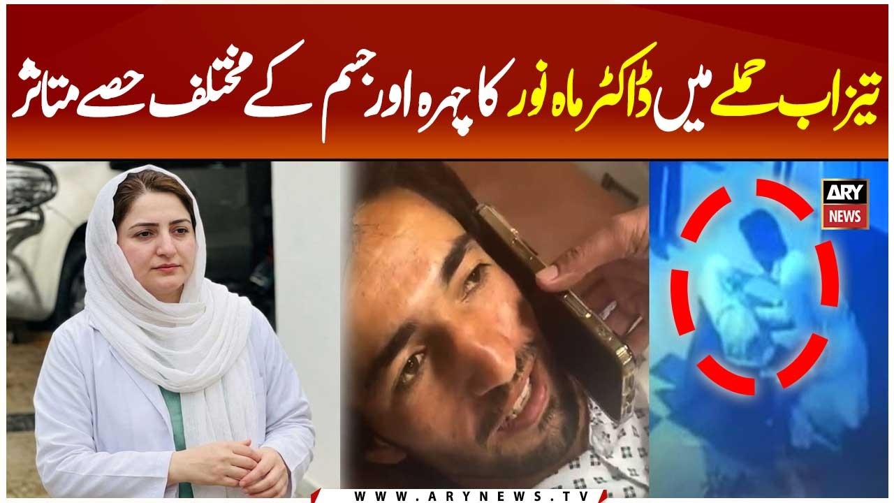Doctor Mahnoor Suffers Severe Injuries in Ac!d Attack