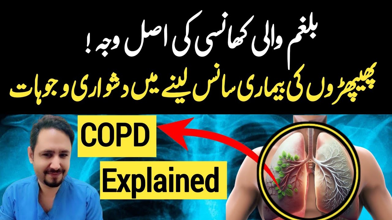 COPD Chronic Obstructive Pulmonary Disease Explained In Urdu Hindi - Dr Irfan Azeem