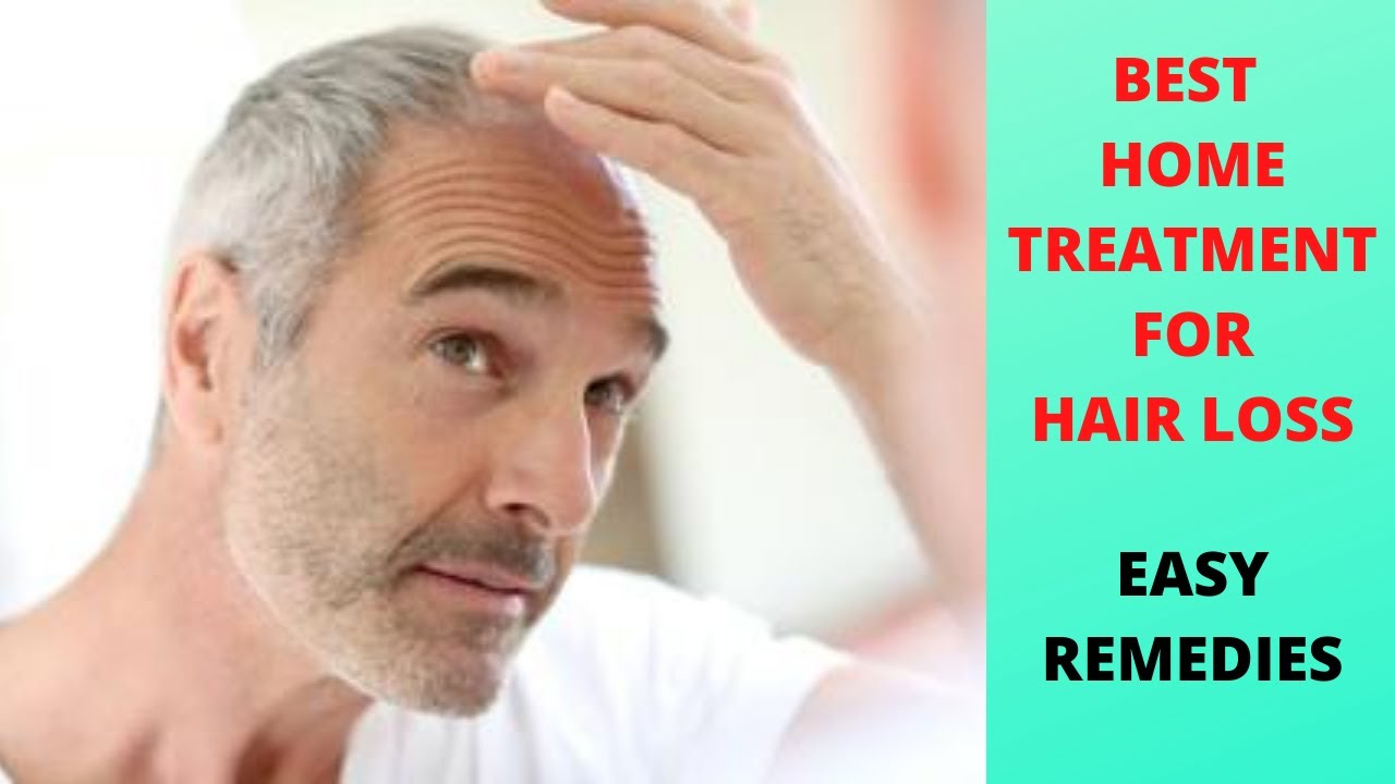 HAIR LOSS|Home remedies for hair loss|Alopecia cure