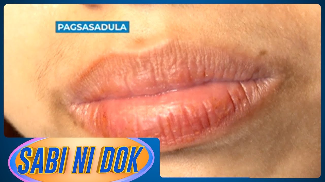 Sabi ni Dok: Solusyon sa dry lips | Gud Morning Kapatid