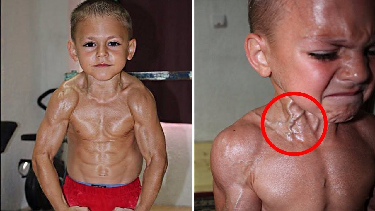 Remember this strong boy? This is how his life turned out...