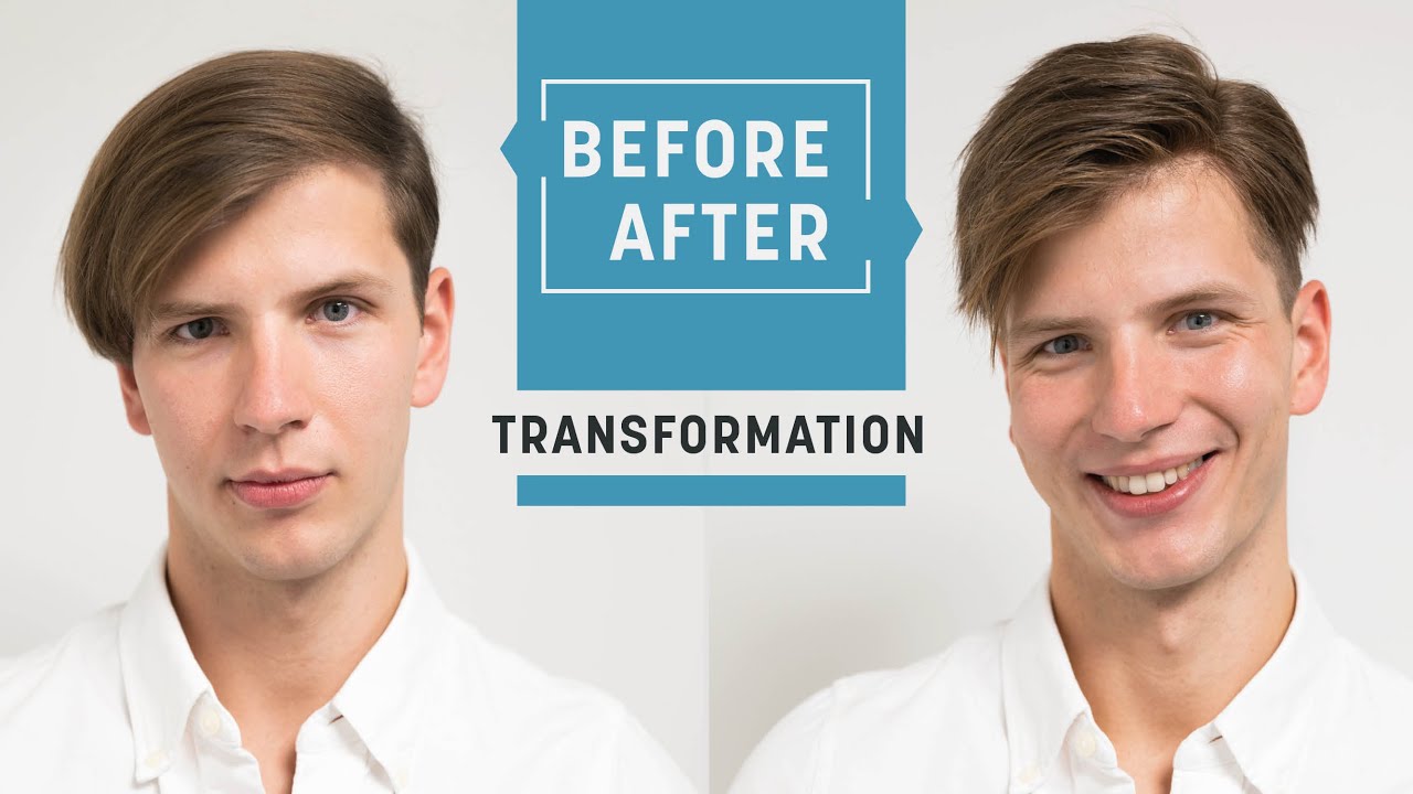 Quick solution to diffuse hair loss | hey2go hairsystem | Hairsystems Heydecke