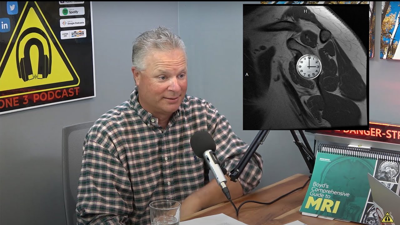 MRI Shoulder with the Clock-Face Method!