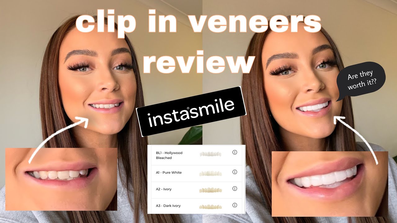 I GOT CLIP IN VENEERS *INSTASMILE REVIEW* Are clip in Veneers WORTH IT?  | Ellie Dawe
