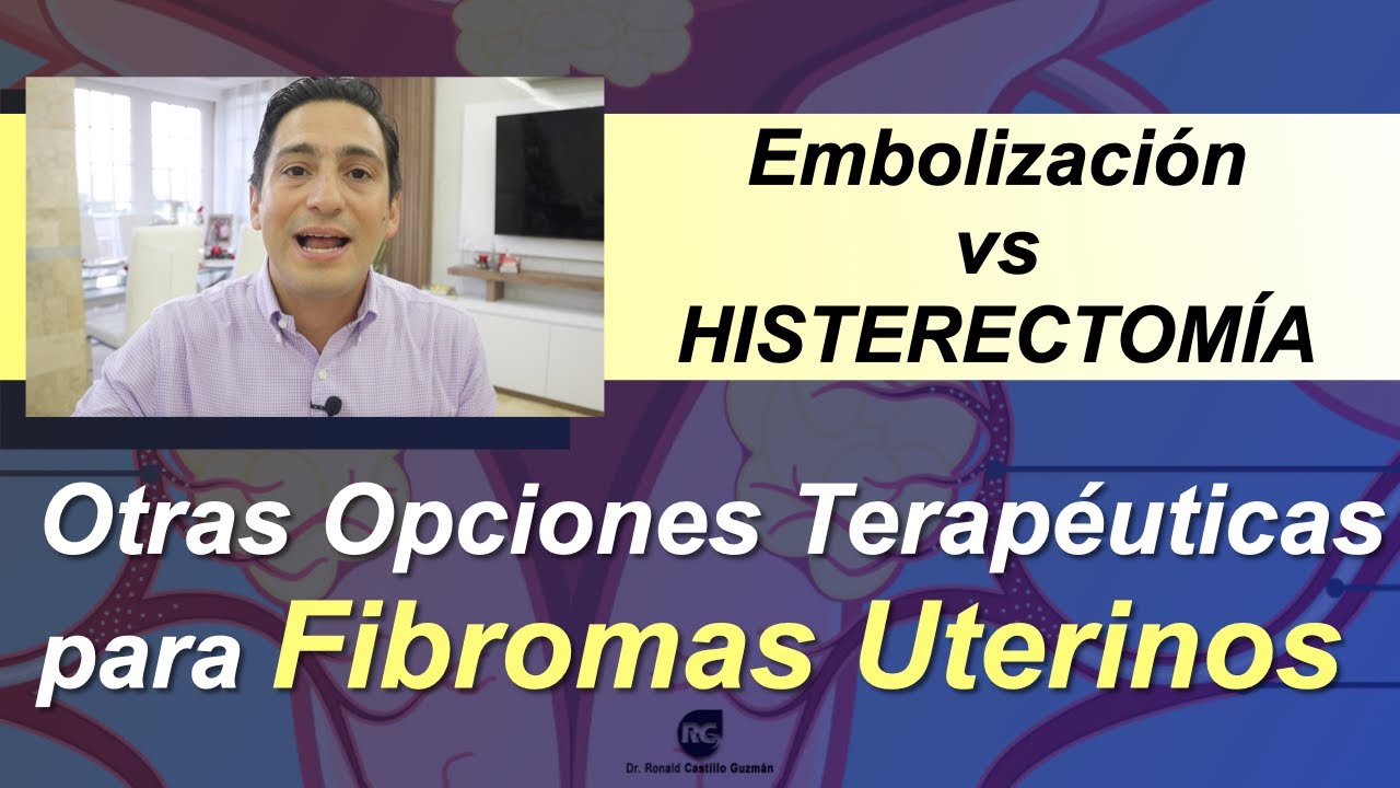 EMBOLIZACI&Oacute;N DE LA ARTERIA UTERINA Y TRATAMIENTO MEDICO DE FIBROMAS UTERINOS VS HISTERECTOMIA