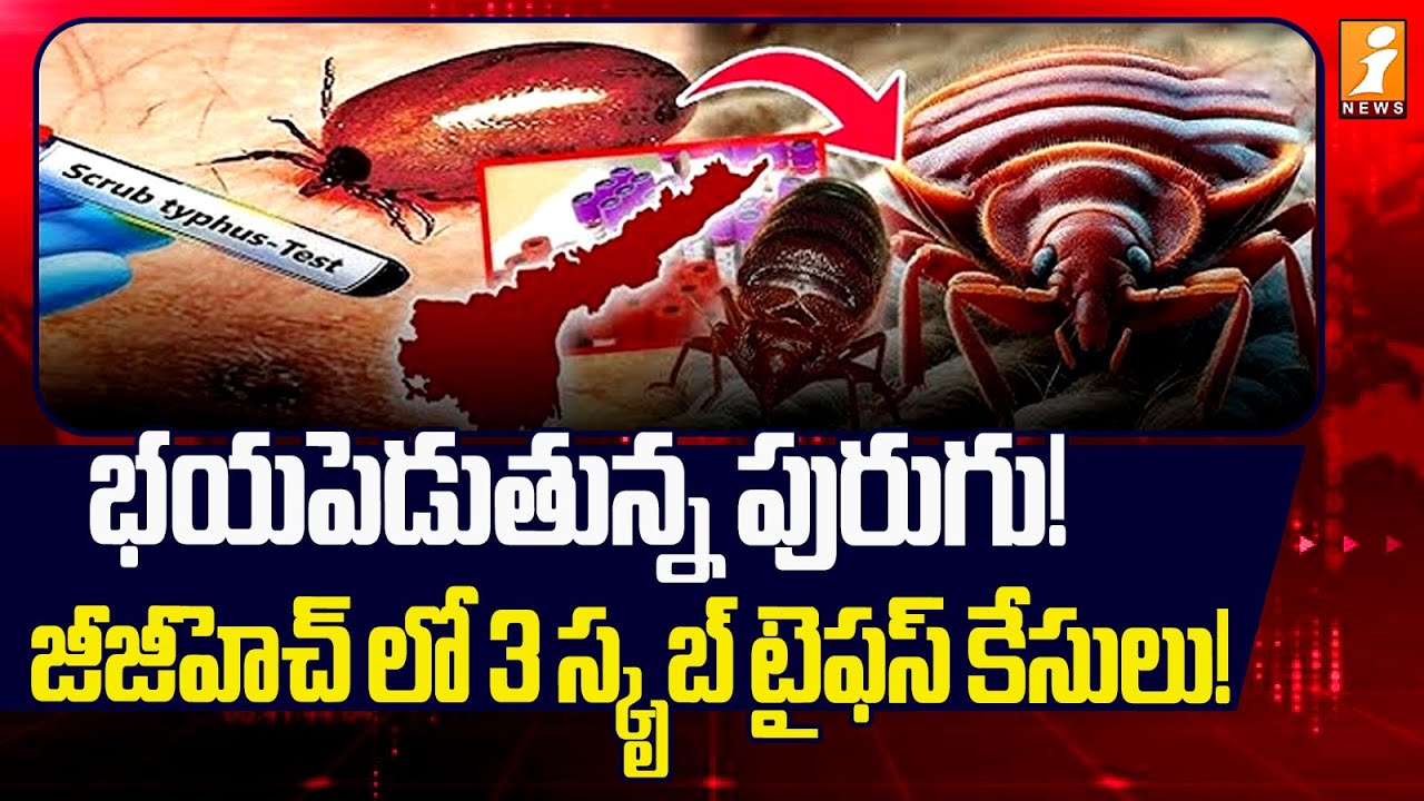 భయపెడుతున్న పురుగు! జీజీహెచ్ లో 3 స్కృబ్ టైఫస్ కేసులు! | Three Scrub Typhus Cases at GGH Guntur