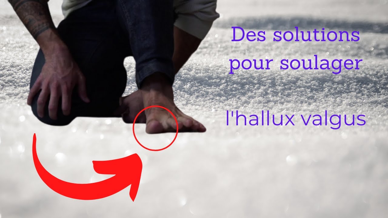 Soulagez votre hallux valgus