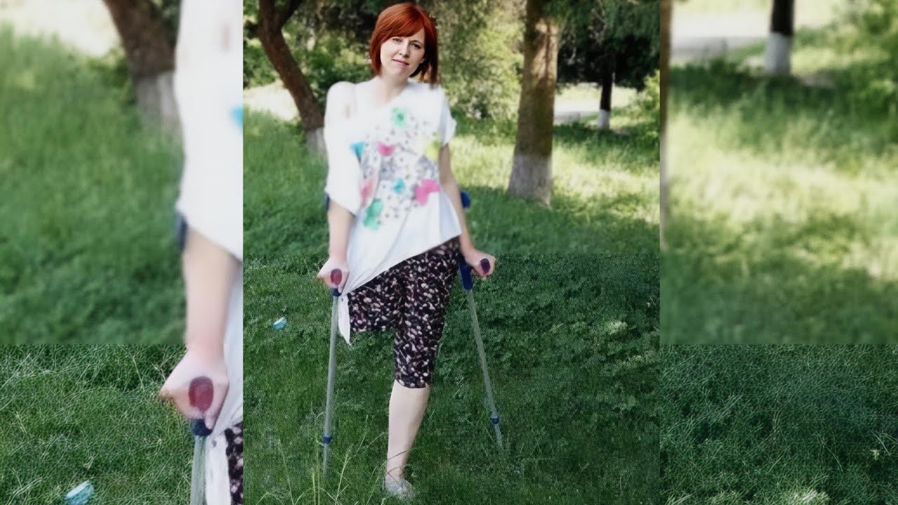 Amputee's Journey: Creating a New Standard of Beauty |Fitness,disability,motivation,devotees,crutche
