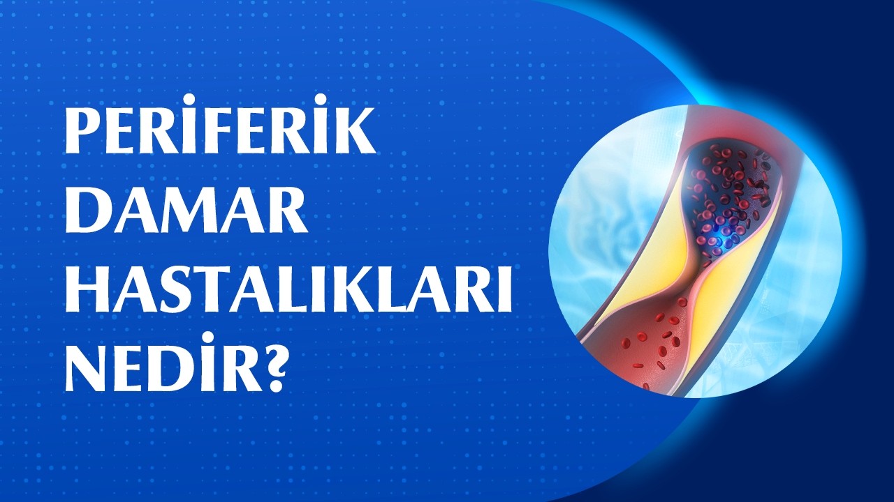 Damar Tıkanıklığı Uzuv Kaybına Yol Açar mı?