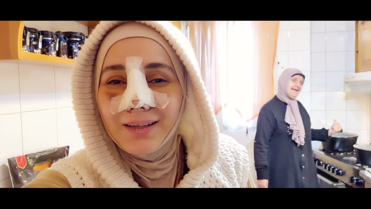 انا خجلانة من حماتي ومش عارفة كيف كافيها؟! عملية أنفي رقم (4)