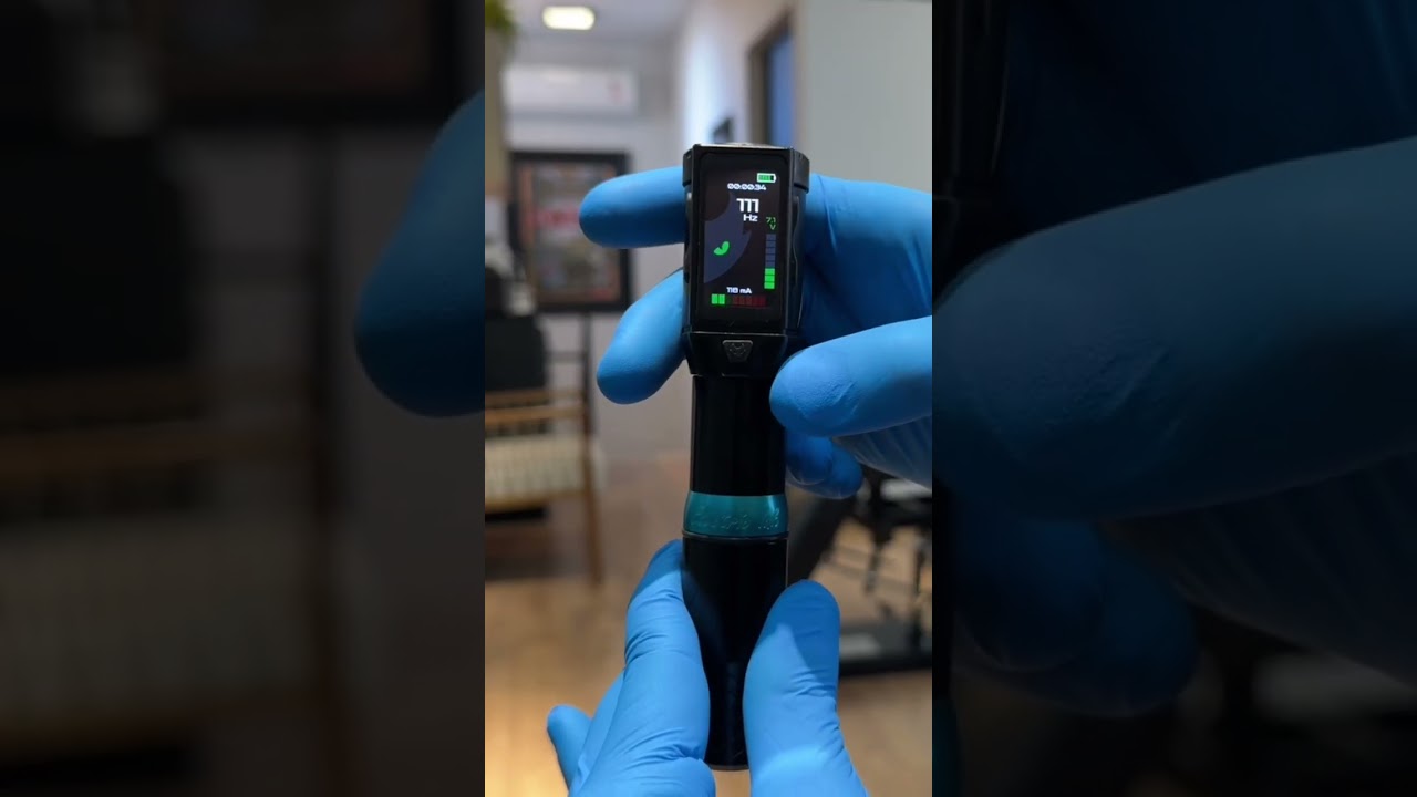 As principais funções que o Lodetti usa na Power 3