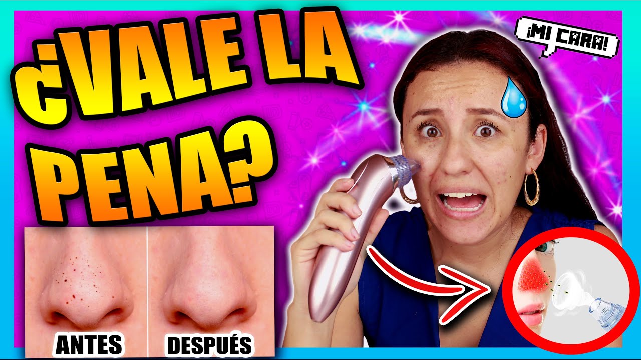 🔥 SUCCIONADOR DE POROS EXTREMO!!!LO pongo a PRUEBA! &iexcl;MUCHO DOLOR! 😩 (100% REAL) 🍓100prekool