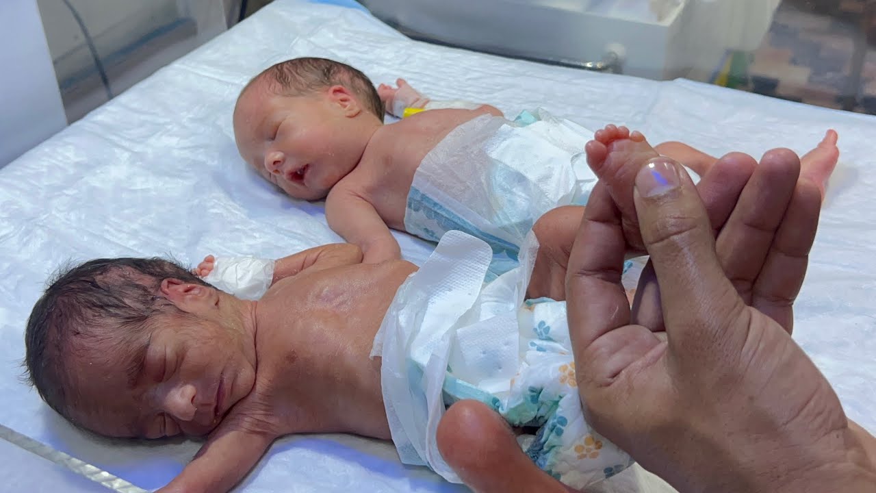 Adorable Little Premature Baby | NICU Day 5 Feeding Movement 🍼💖