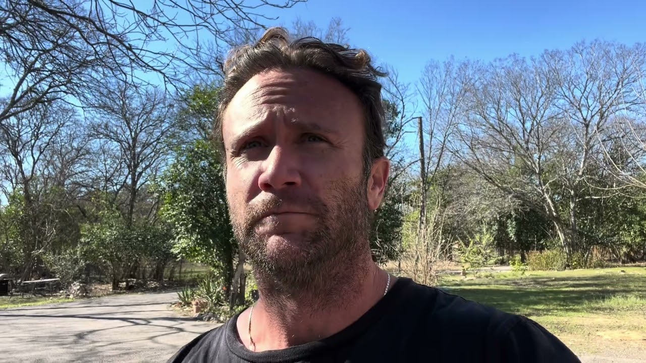 Month 11 - Cosmedica Hair Transplant