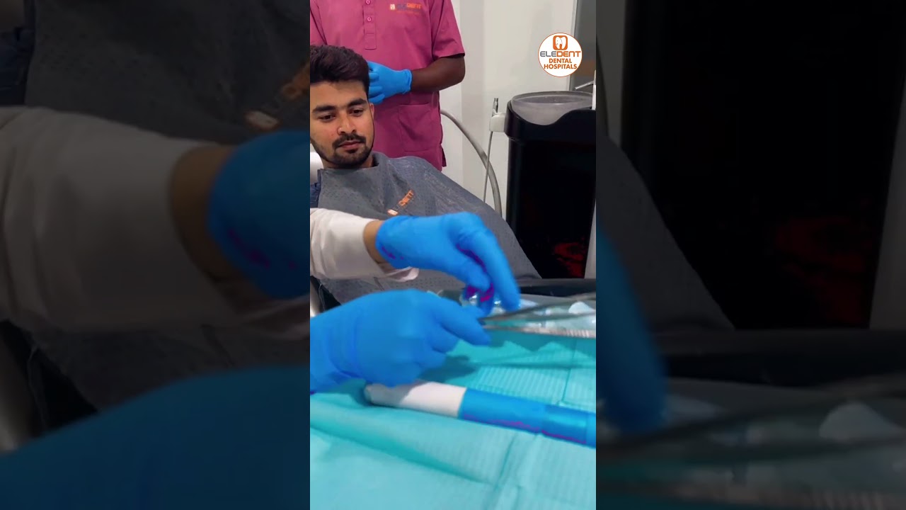 Live🔴: How We Treat | Best Dental Hospital At Hyderabad | Eledent Dental Hospitals | Dr Shilpa