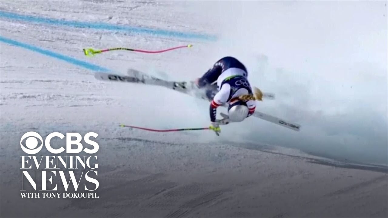 Lindsey Vonn breaks leg in Olympic crash, Trump calls skier a loser for comments on U.S. politics