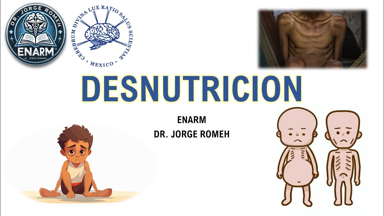 DESNUTRICION - ENARM - TODO LO QUE DEBES SABER