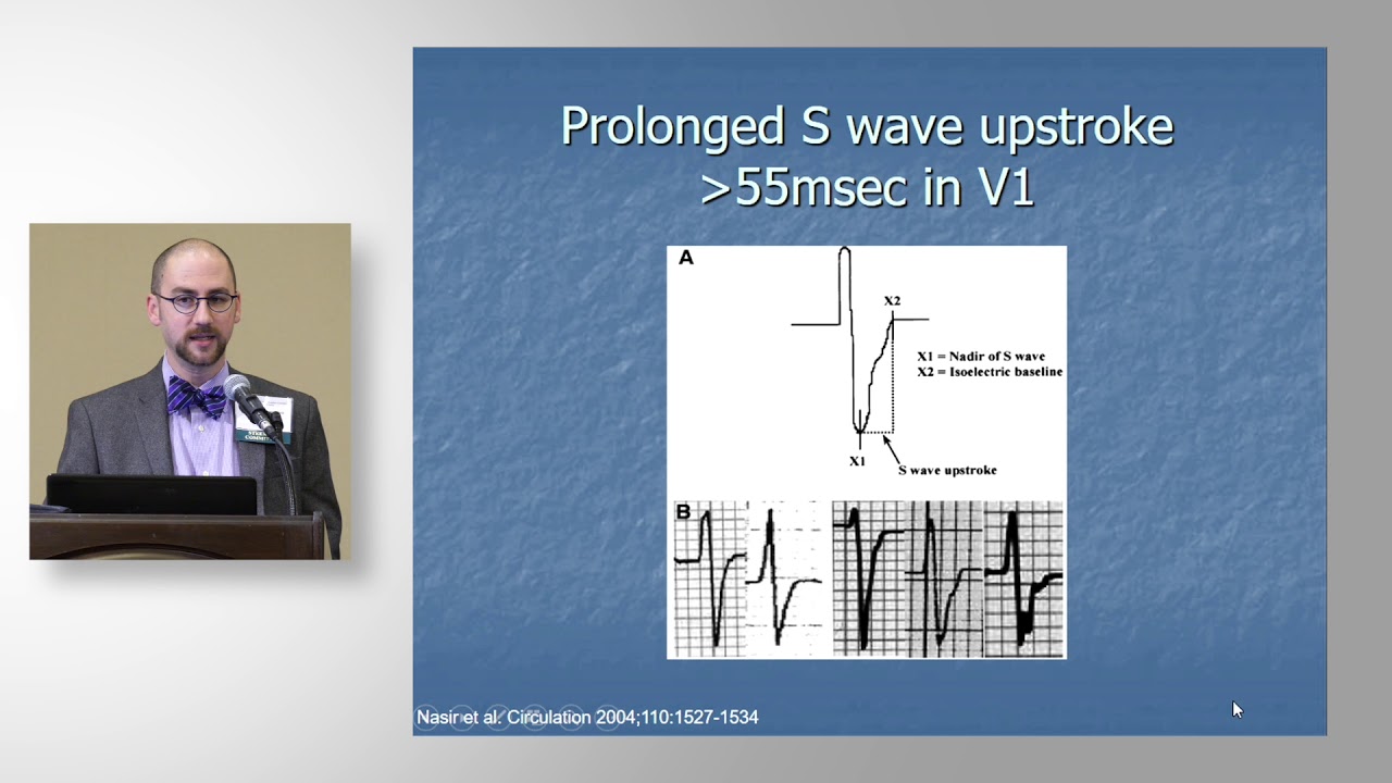 Jordan Prutkin, MD, Diagnostic Evaluation of ECG Abnormalities Suggestive of Arrhythmogenic Cardiomy