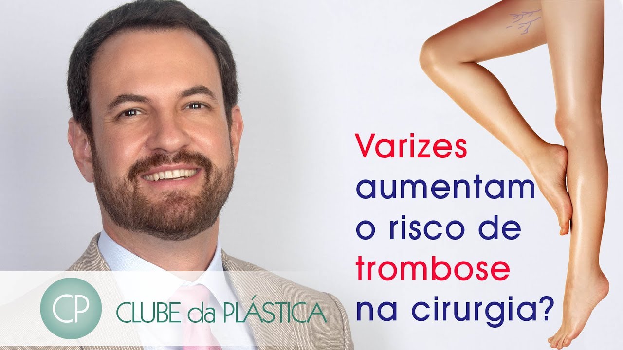 Clube da Plástica: Varizes aumentam risco de trombose na cirurgia?
