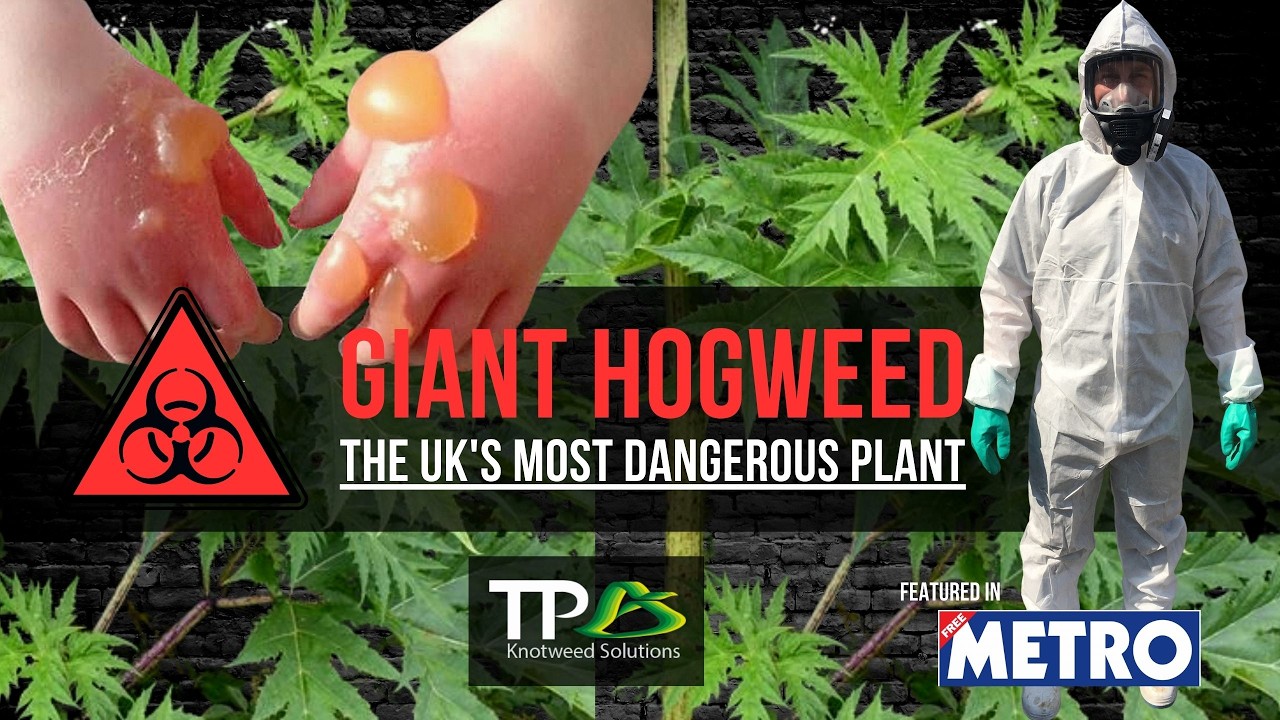 Giant Hogweed - The UK's Most Dangerous & TOXIC Plant #gianthogweed