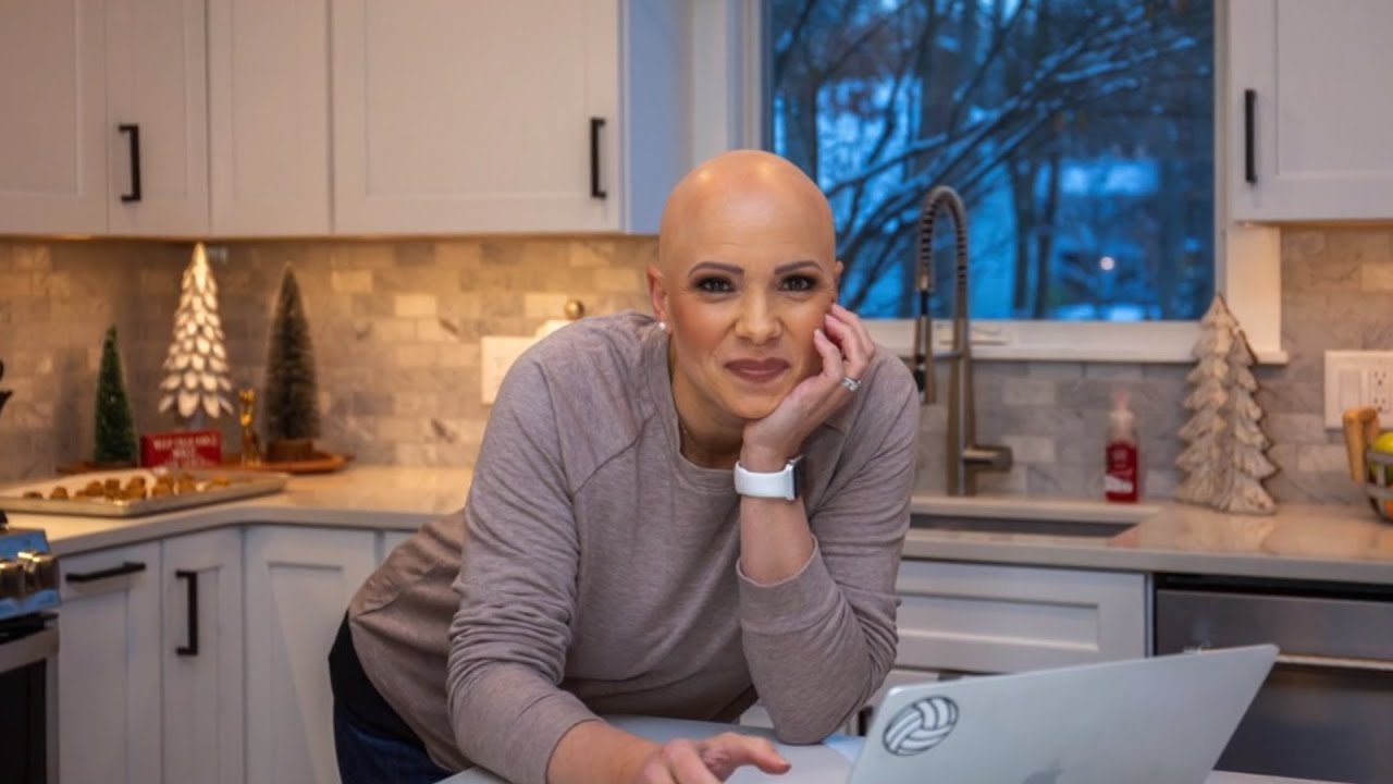 Bald is Beautiful: How One Woman is Showing Us Beauty Starts from Within
