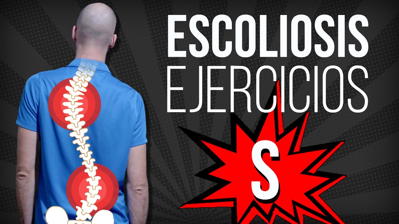 ESCOLIOSIS en S 👉 EJERCICIOS correctivos