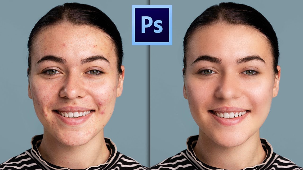 2 Teknik Mudah Skin Retouching di Photoshop