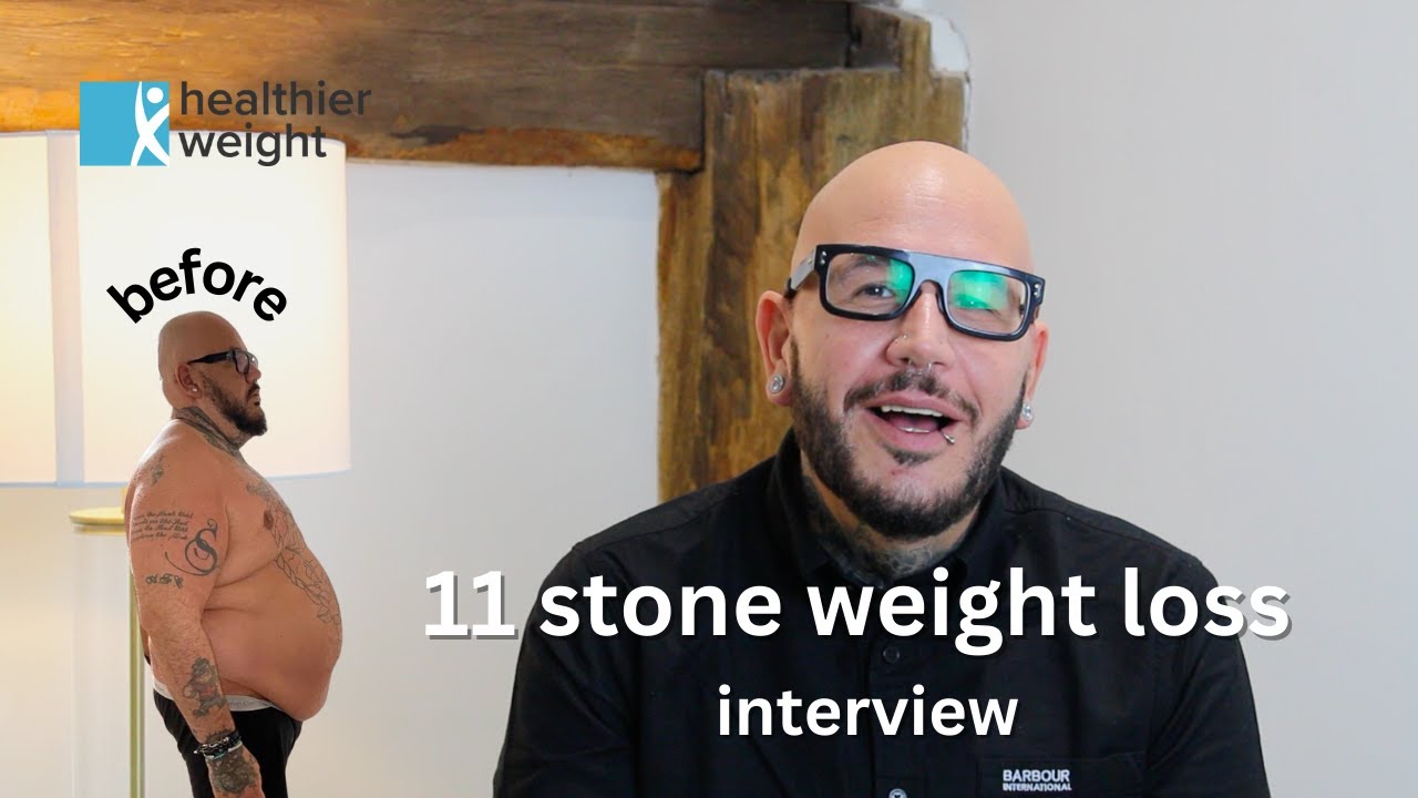 Massimo's Gastric Sleeve - 11 Stone Lost