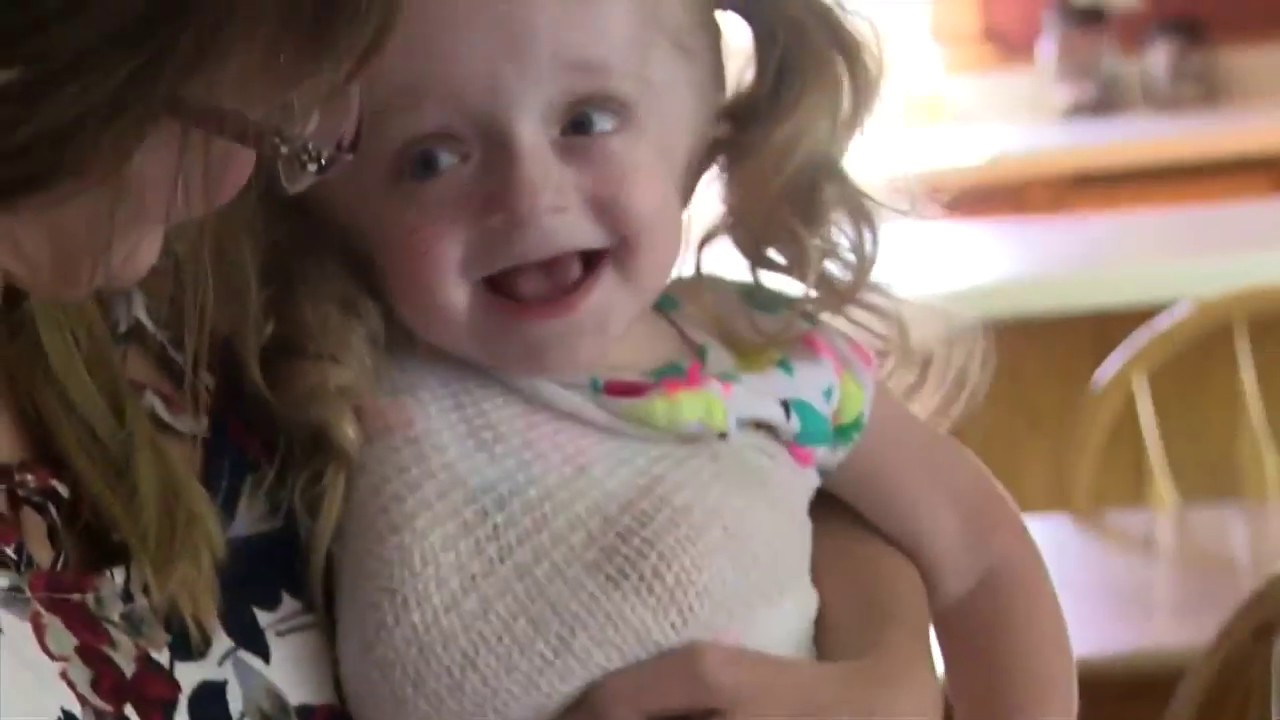 Unbreakable Hope: Toddler Receives Life-Changing Rod Surgery
