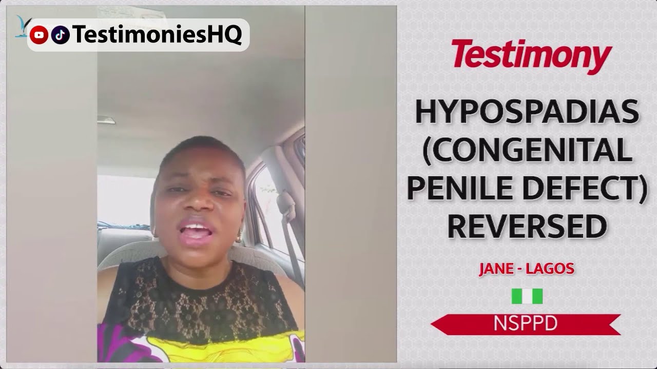 Miraculous Healing of Baby Boy with Hypospadias (Congenital Penile Defect) | Inspiring Testimony