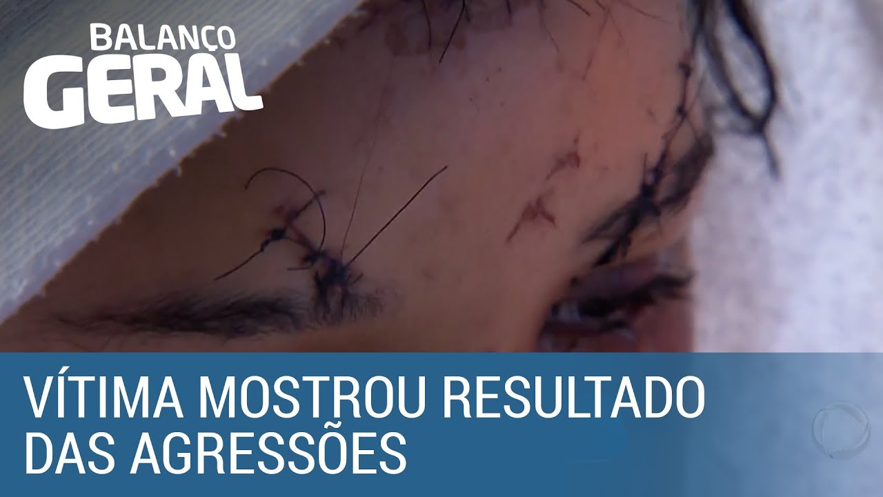 Sobrevivente de tragédia em Paraisópolis relata agressão de policiais