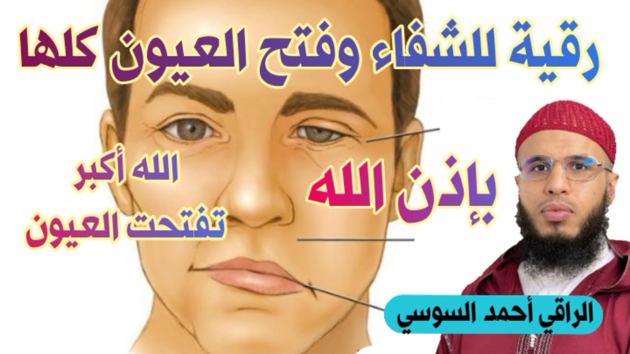 رقية للشفاء وفتح العيون كلها بأمر الله ruqyay