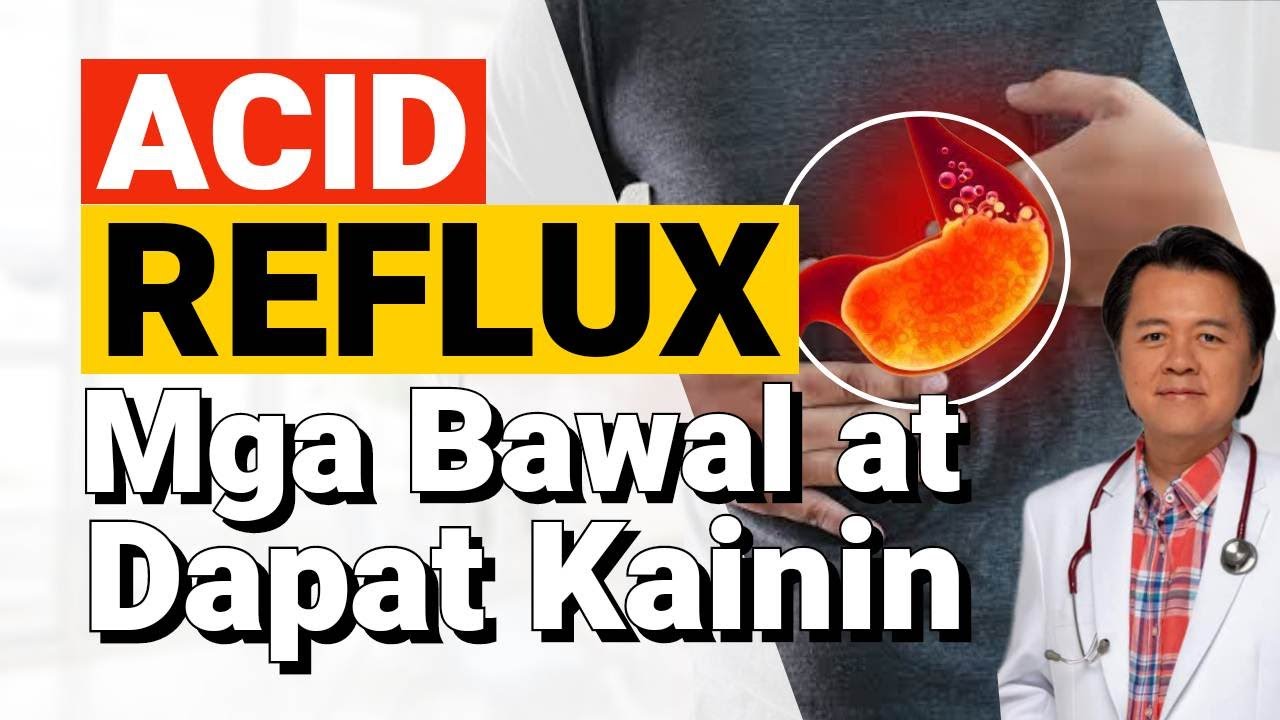 Acid Reflux: Mga Bawal at Dapat Kainin - By Doc Willie Ong (Internist and Cardiologist)