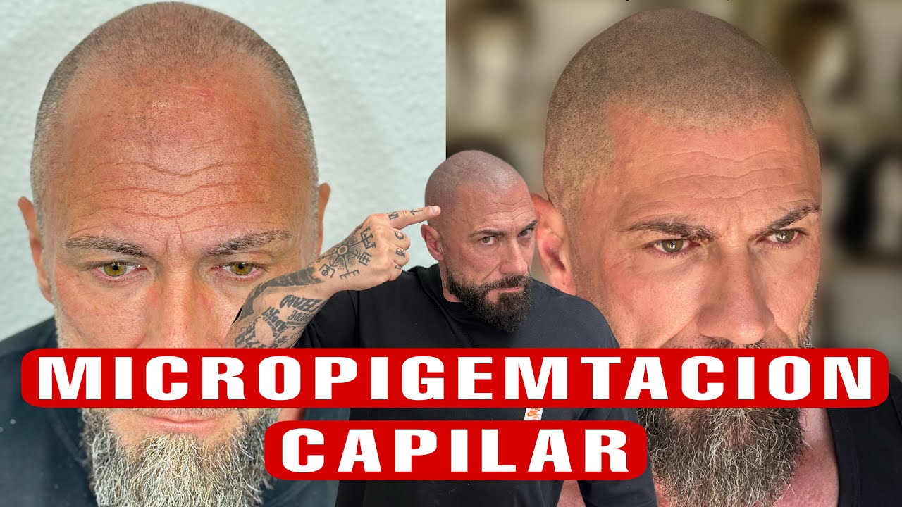 Así es una sesión real de Micropigmentación capilar