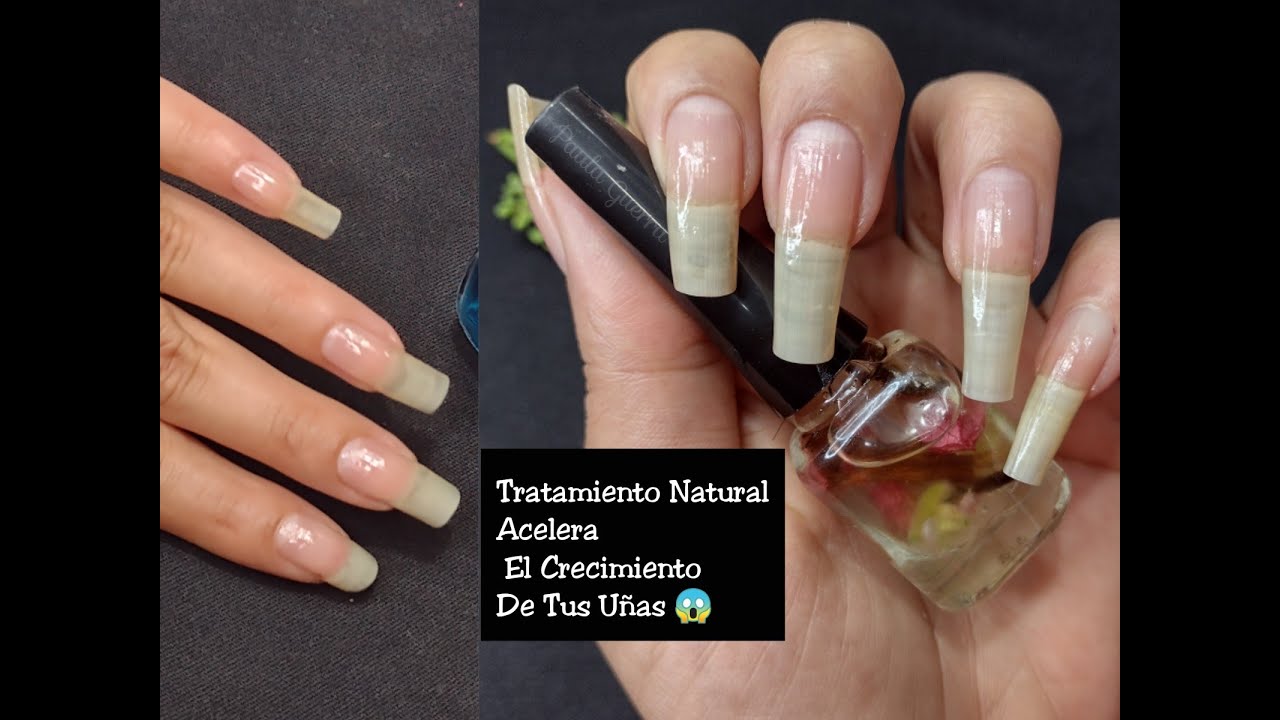 TRATAMIENTO NATURAL ACELERA EL CRECIMIENTO DE TUS UÑAS 😱