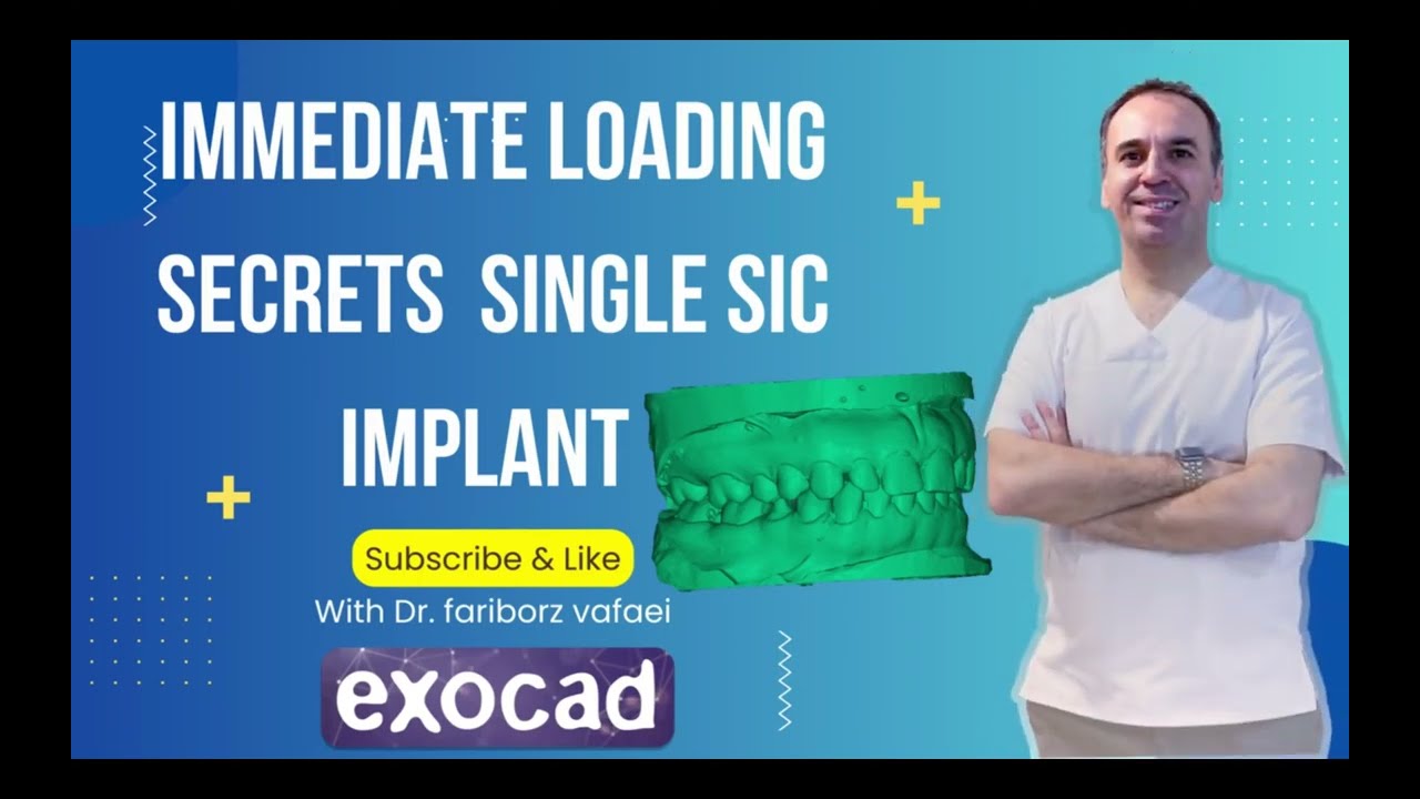 IMEEDIATE LOADING EXOPLAN EXOCADpart 2