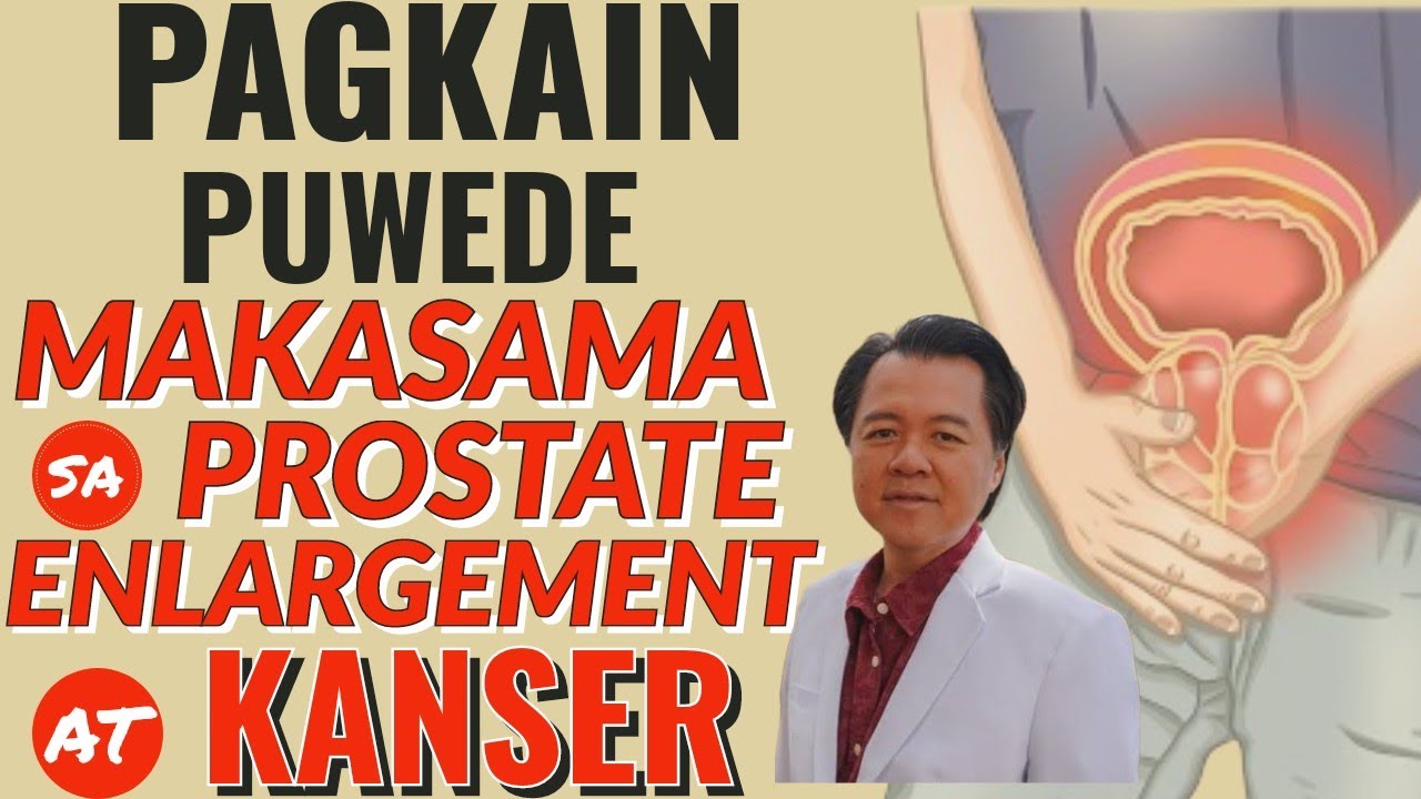 Mga Pagkain Puwede Makasama sa Prostate Enlargement at Kan-ser - By Doc Willie Ong