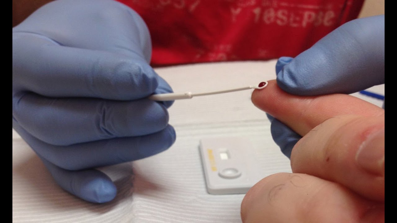 Diagnóstico de infección por VIH: Algoritmo CDC-APHL