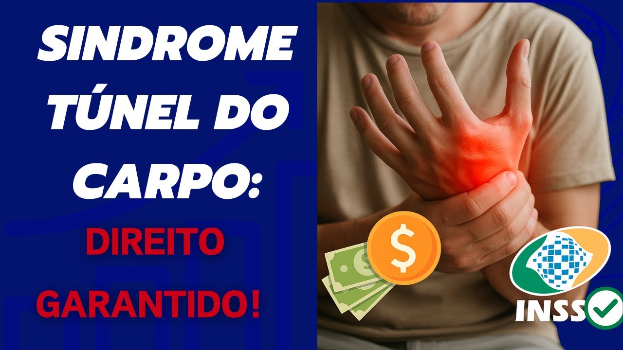 ATENÇÃO: Você SABIA que a SÍNDROME DO TÚNEL DO CARPO dá DIREITO a BENEFÍCIOS do INSS? DESCUBRA AGORA