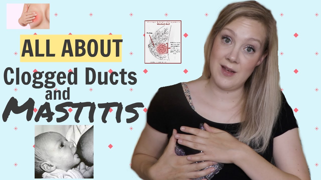 10 Things Your Labor Nurse Wants You to Know About Clogged Ducts and Mastitis