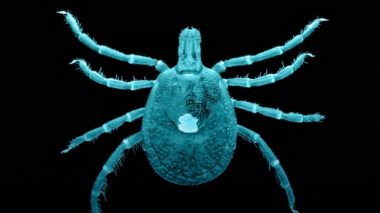 La garrapata estrella solitaria causa alergias alimentarias