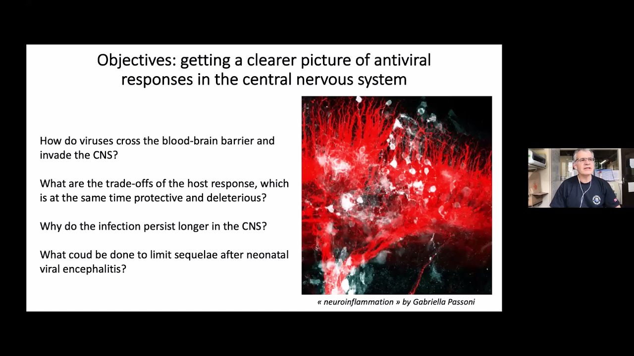 Interferon response in the brain, and viral encephalitis