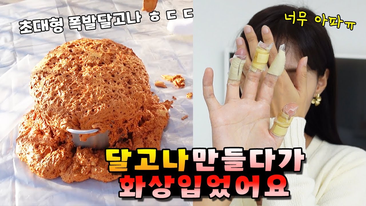 초대형 폭발 달고나 만들기 하다가 화상 입었습니다ㅠ 여러분 달고나 조심하세요ㅠ 가족 일상 브이로그 vlogㅣ토깽이네