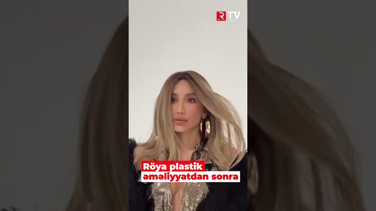 R&ouml;ya plastik əməliyyatdan sonra