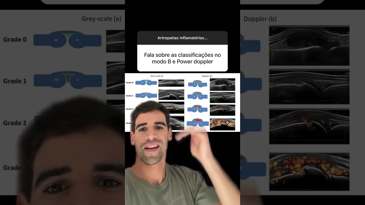 EULAR-OMERACT - Pode me ajudar? Que bicho &eacute; esse? 🤯 #shorts