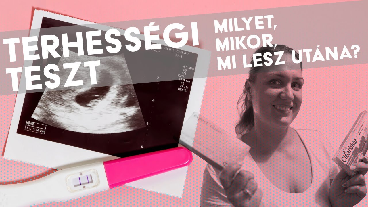 TERHESSÉGI TESZT: ha csak egy videót szeretnél megnézni róla