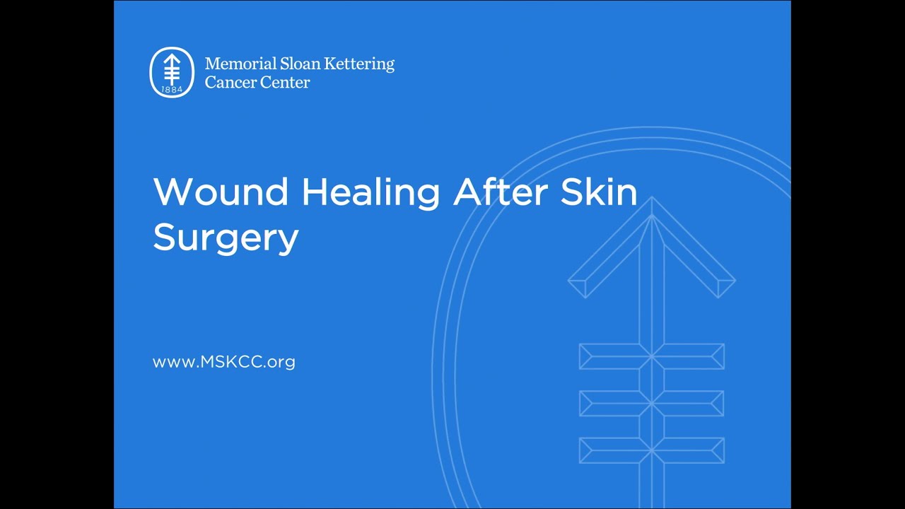 Wound Healing After Skin Surgery | Memorial Sloan Kettering