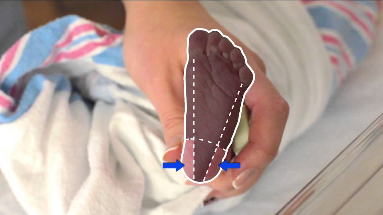CLSI Newborn Screening DVD | Informational Video (Clip)